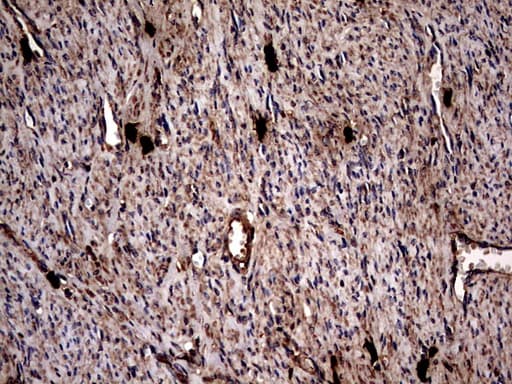 Monoclonal Mouse anti-Human GBA / Glucosidase Beta Acid Antibody (clone OTI4G4, aa40-315, IHC, WB)