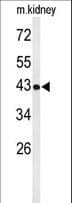 UBXN6 / UBXD1 Antibody (aa281-309)