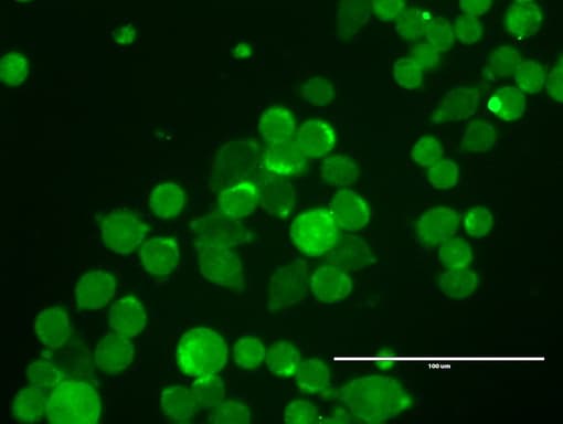 ERBB2 / HER2 Antibody (aa676-1255, clone UMAB34)