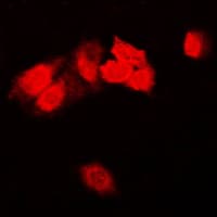 Polyclonal Rabbit anti-Human FAK / Focal Adhesion Kinase Antibody (Internal, IHC, IF, WB)