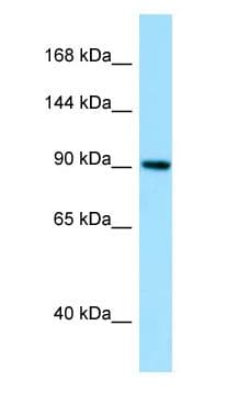 Polyclonal Rabbit anti-Human GBE1 Antibody (aa176-225, WB)
