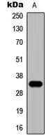 ZNF75 / ZNF75D Antibody (C-Terminus)
