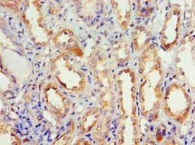 DVL2 / Dishevelled 2 Antibody (aa1-240)