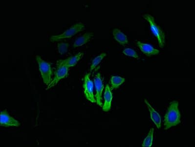 Polyclonal Rabbit anti-Human TXNDC11 Antibody (IHC)