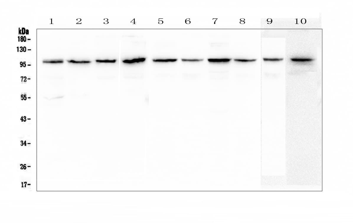 PLG / Plasmin / Plasminogen Antibody