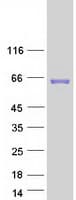 Human Carboxylesterase 3 / CES3 Protein (Recombinant Myc-DDK (Flag))