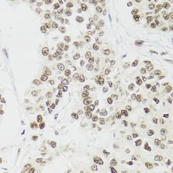 EDF1 / MBF1 Antibody
