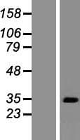 TWISTNB Protein (Over-Expression Lysate Myc-DDK (Flag))