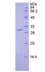 Human DLAT / PDC-E2 Protein (Recombinant His, N-Terminal)