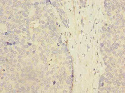 Polyclonal Rabbit anti-Human ZNF707 Antibody (IHC)