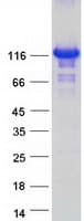Human ZHX3 Protein (Recombinant Myc-DDK (Flag))
