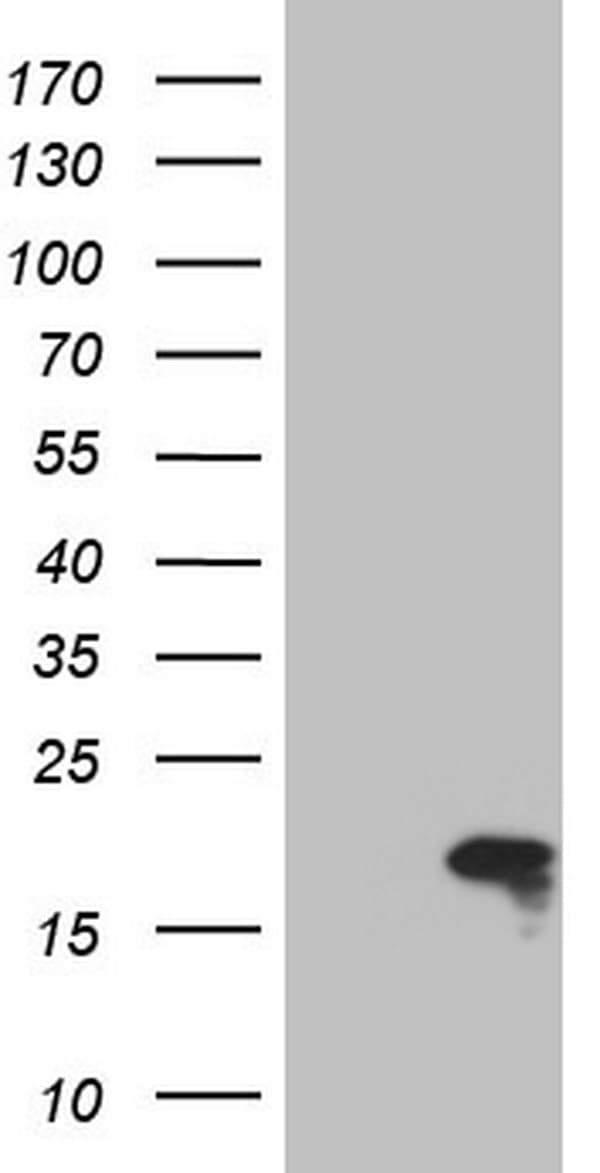 TWIST2 Antibody (clone OTI1C4)