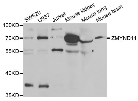 ZMYND11 / BS69 Antibody