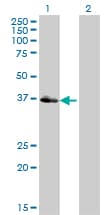 Monoclonal Mouse anti-Human POU4F3 / BRN3C Antibody (clone 5B8, IF, WB)