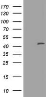 MAGEA3 Antibody (clone OTI3B2, Carrier-free)