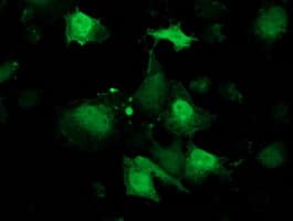 RBP1 / CRBP Antibody (clone OTI2H3)