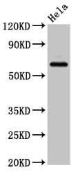 Polyclonal Rabbit anti-Human SLC22A25 Antibody (IHC, WB)