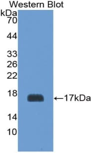 GP1BB / CD42c Antibody (aa53-176)