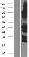 SYCE1 Protein (Over-Expression Lysate Myc-DDK (Flag))