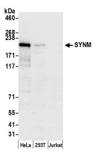 DMN / Desmuslin / Synemin Antibody (aa1350-1400)