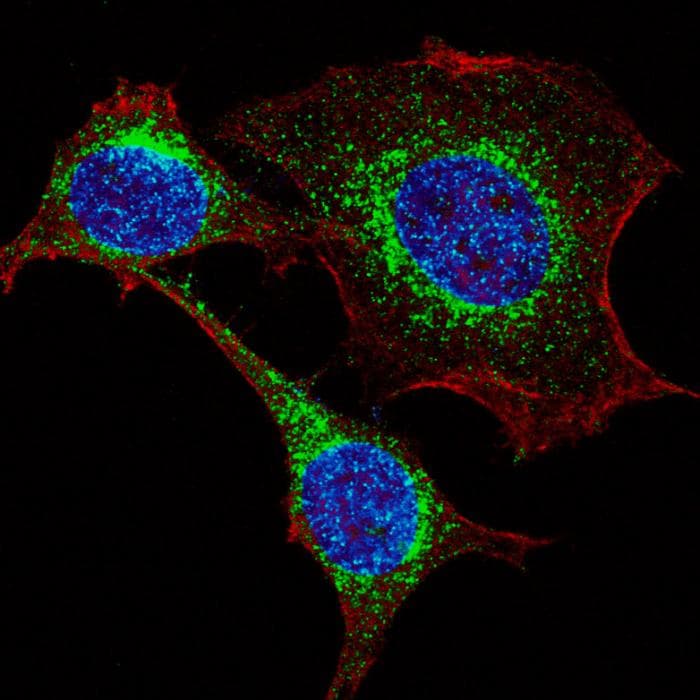 Polyclonal Rabbit anti-Human Fragilis / IFITM3 Antibody (aa1-30, IF, WB)