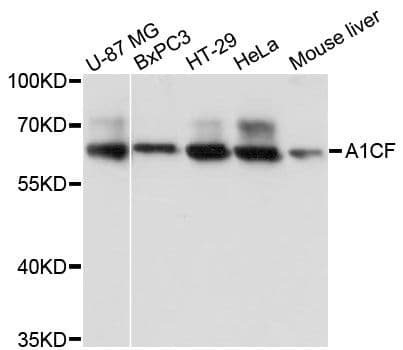 Polyclonal Rabbit anti-Human A1CF / ACF Antibody (WB)