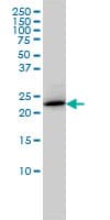 RAB6A / RAB6 Antibody (clone 3G3)
