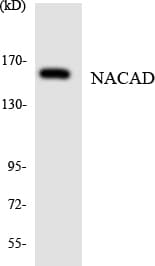 Polyclonal Rabbit anti-Human NACAD Antibody (aa359-408, WB)
