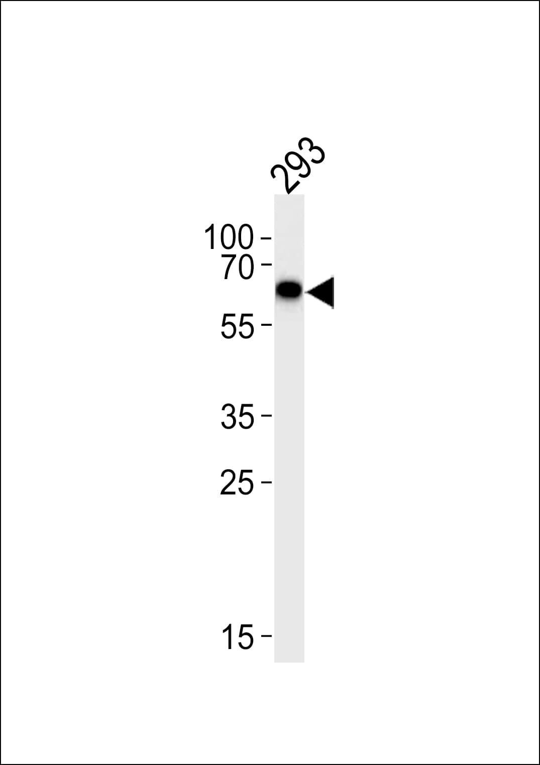 STK39 / SPAK Antibody (aa346-376)
