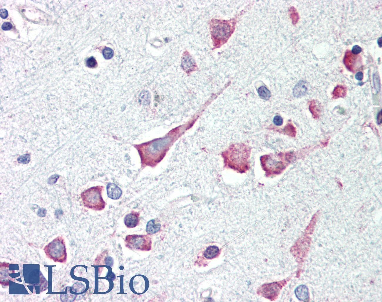 IHC-plus™ DAPK3 / ZIP Kinase Antibody