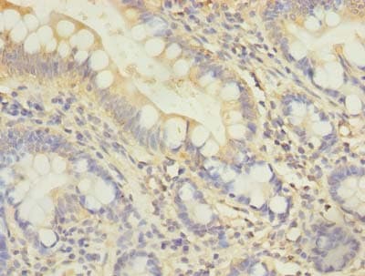 DDHD2 Antibody