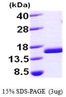 Human FIS1 Protein (Recombinant His)