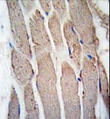 GREM1 / Gremlin-1 Antibody (aa147-175)