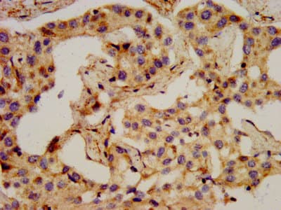 Polyclonal Rabbit anti-Human PCSK2 Antibody (IHC, WB)