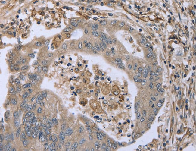 FAP Alpha Antibody