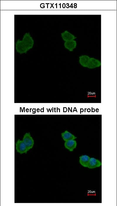 IHC-plus™ ACY1 / Aminoacylase 1 Antibody