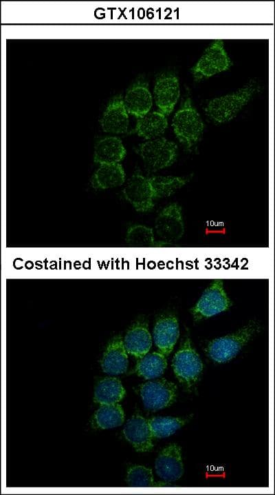 ST3GAL1 Antibody (aa1-195)