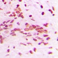 Polyclonal Rabbit anti-Human PCNA Antibody (Internal, IHC, WB)