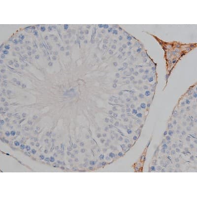 MAPT / Tau Antibody (phospho-Ser422)