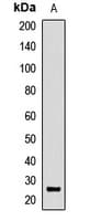 UBB / Ubiquitin B Antibody