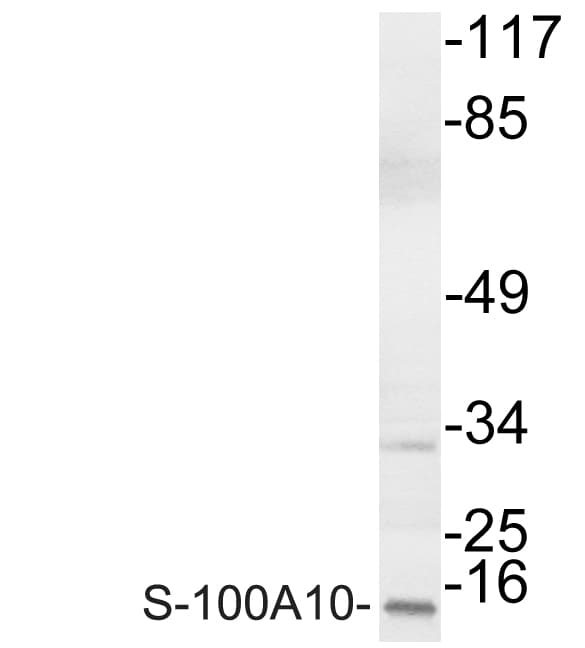 S100A10 Antibody (Val52)