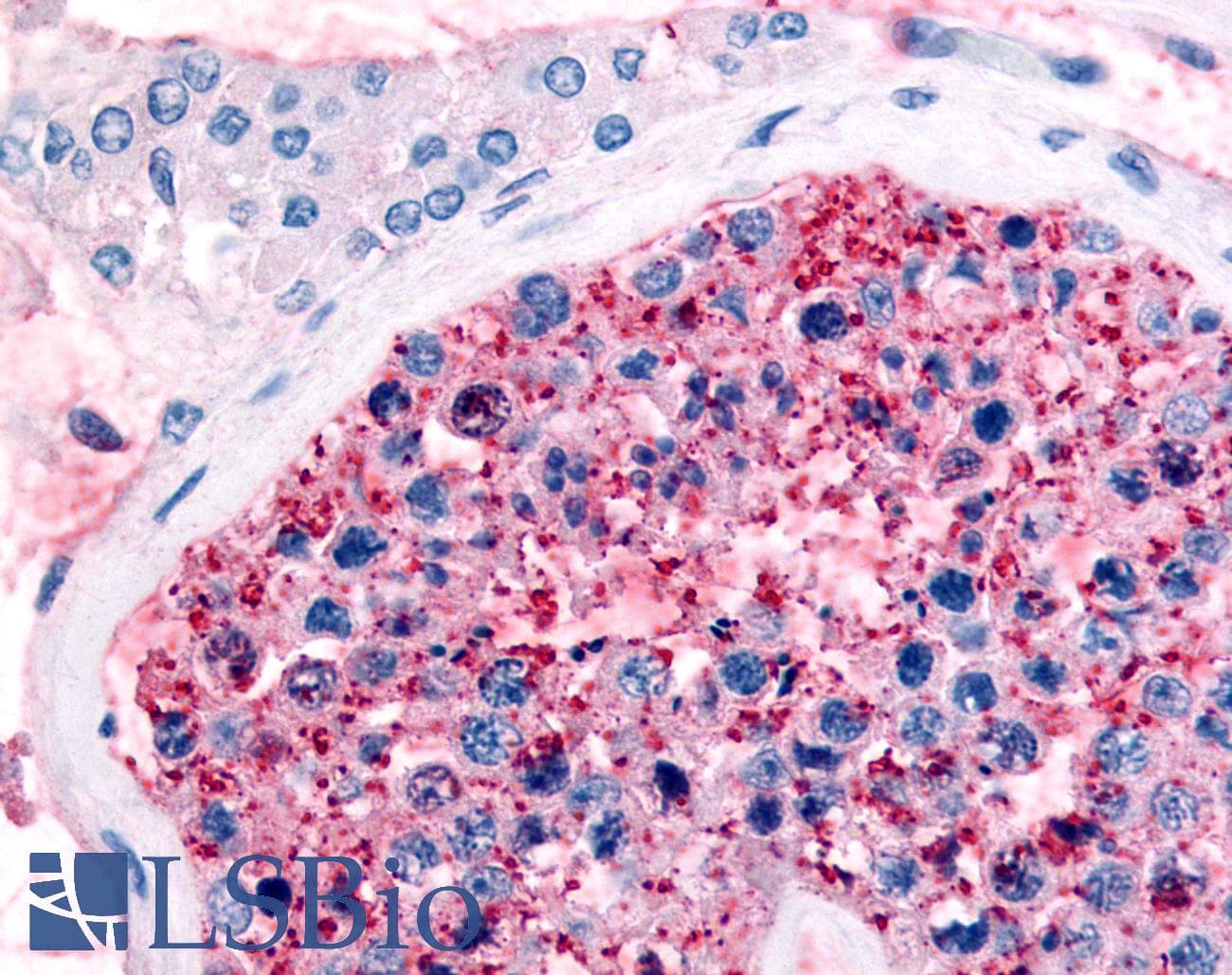 IHC-plus™ FZD9 / Frizzled 9 Antibody (Extracellular Domain)