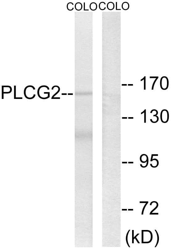 IHC-plus™ PLCG2 / PLC Gamma 2 Antibody (aa721-770)