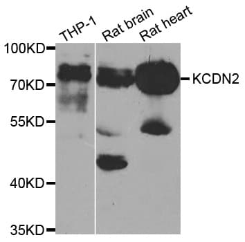 KCND2 / Kv4.2 Antibody