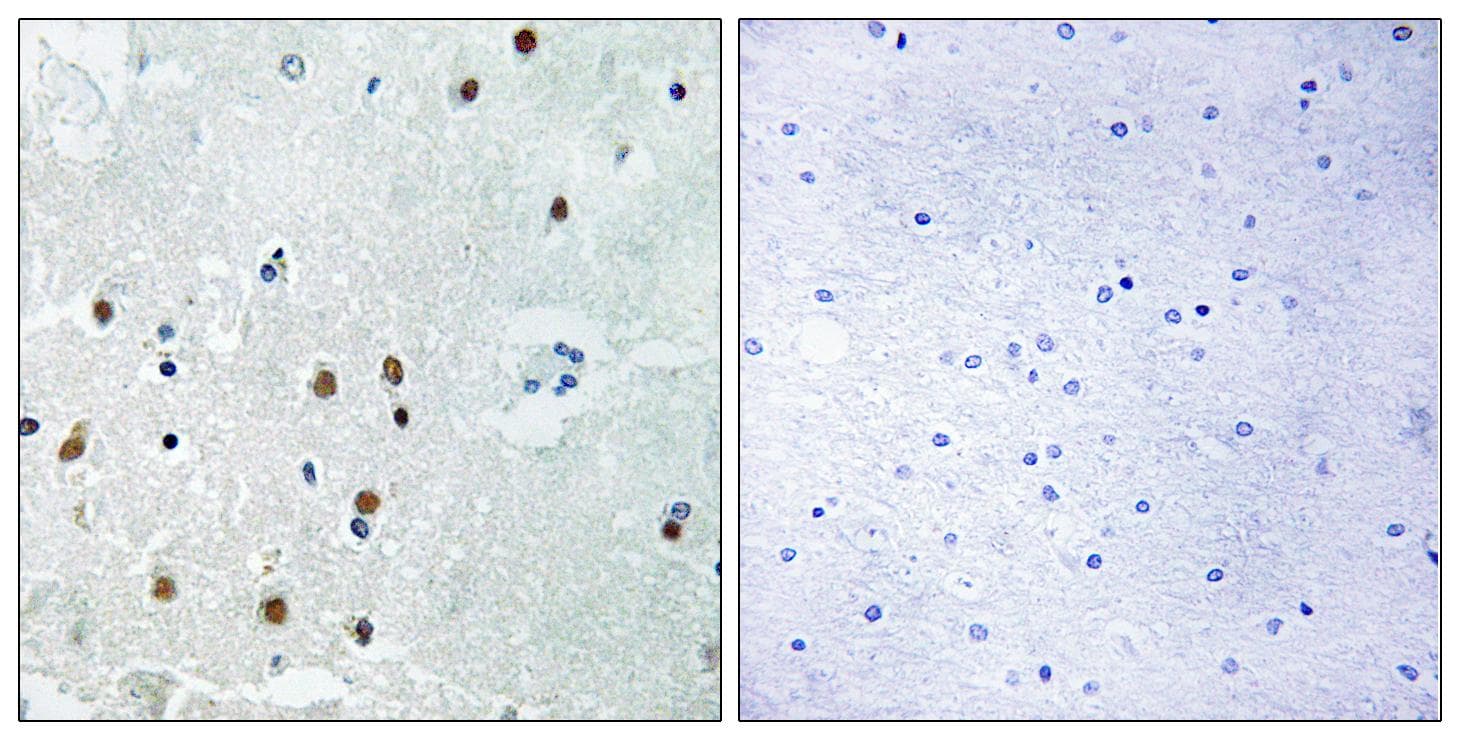 ARHGAP18 Antibody