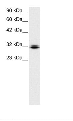 RAX / RX Antibody (N-Terminus)