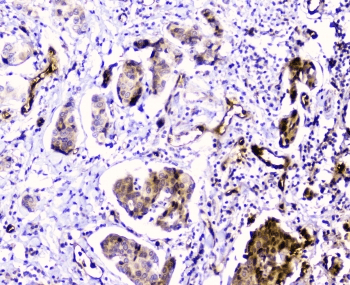 Polyclonal Rabbit anti-Human CDA / Cytidine Deaminase Antibody (IHC, WB)