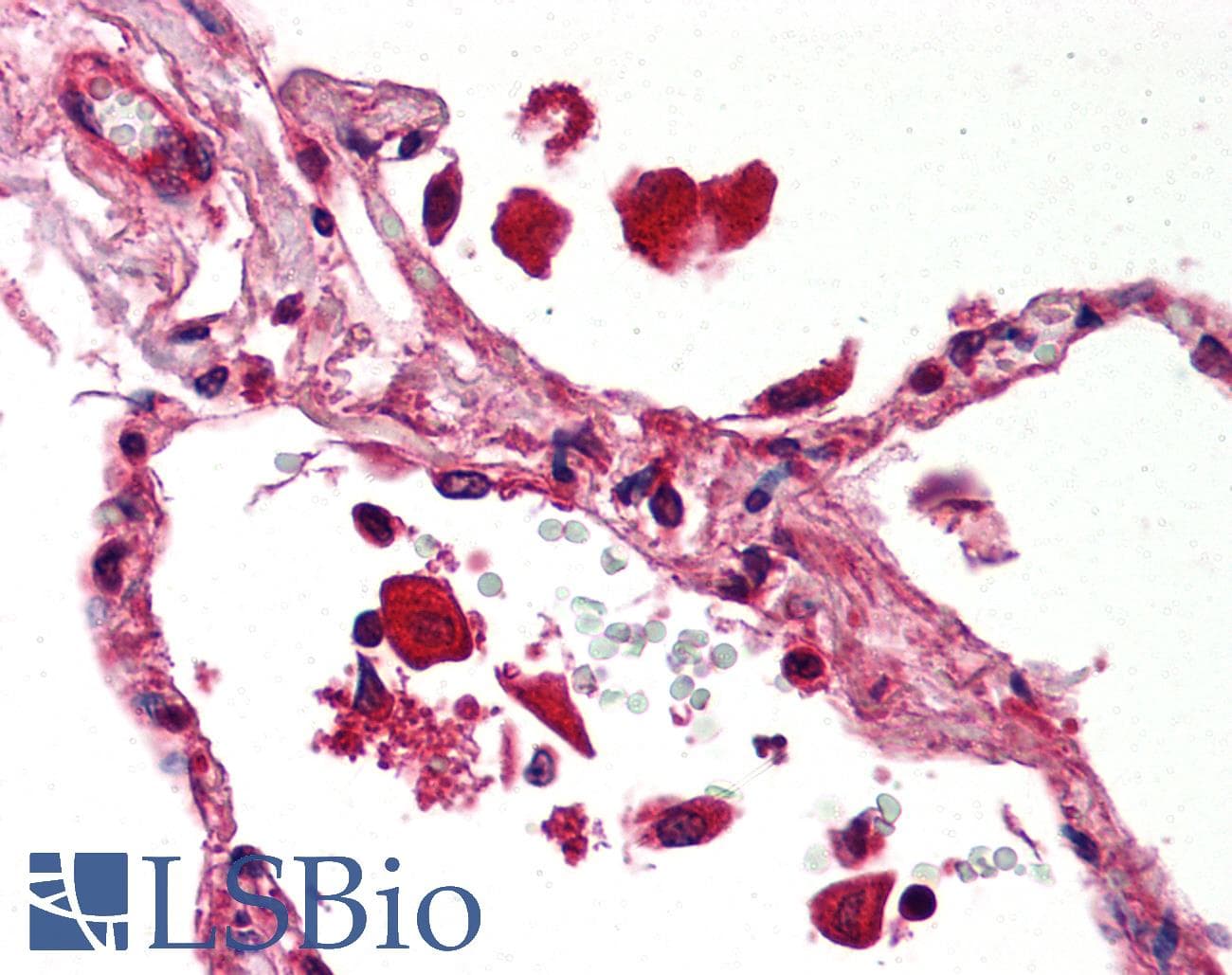 IHC-plus™ STAT1 Antibody (clone SM1)