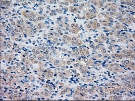 NRBP1 / NRBP Antibody (clone OTI2A5)