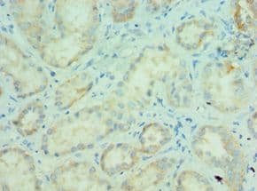 MLANA / Melan-A Antibody (aa48-118)
